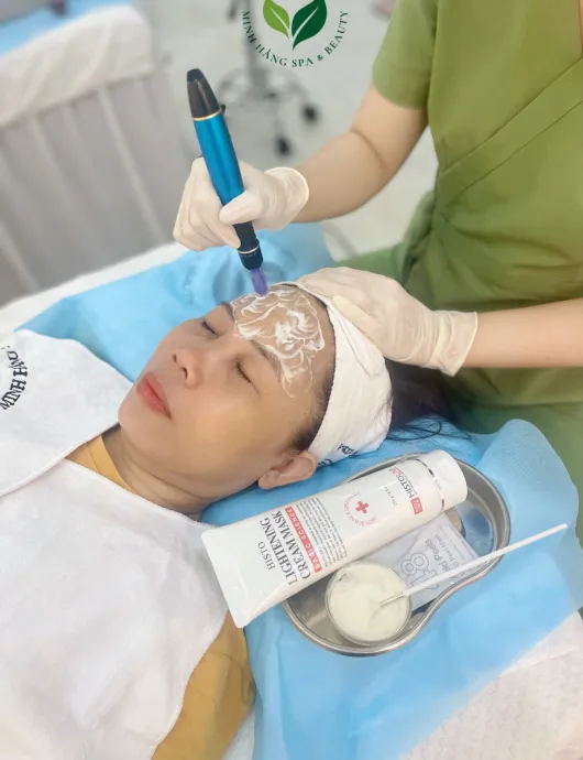 Cấy colagen tươi căng bóng